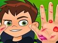 Игра Ben10 Ръчен лекар  онлайн