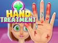 Игра Лечение на ръцете  онлайн