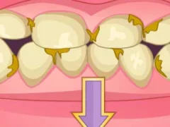 Bad Teeth Makeover — безплатна онлайн игра