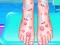 Emma Foot Treatment — безплатна онлайн игра
