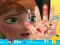 Anna hand doctor — безплатна онлайн игра
