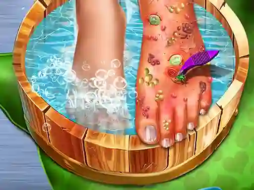 Feet Skin Doctor — безплатна онлайн игра
