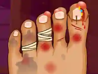 Monster Foot Doctor — безплатна онлайн игра