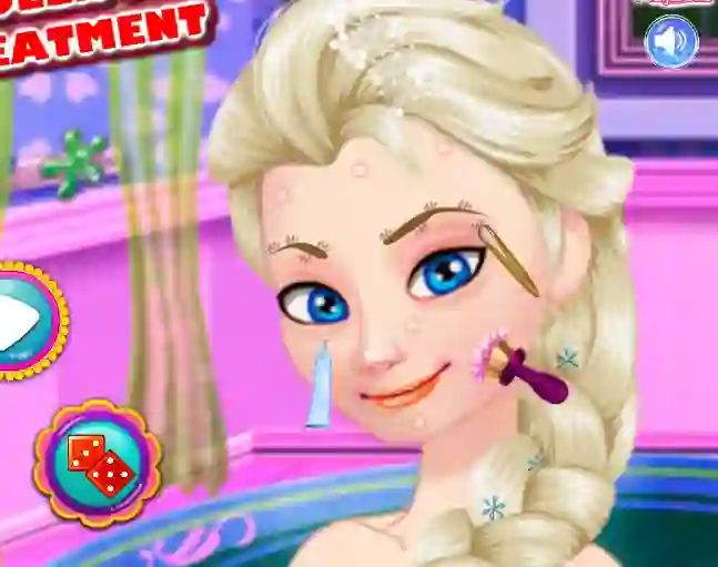 Ice Queen Acne Treatment — безплатна онлайн игра