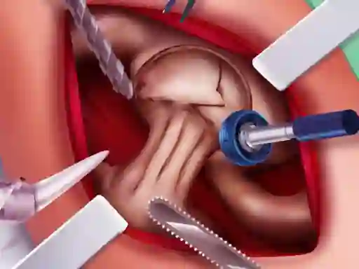 Princess Hips Surgery — безплатна онлайн игра