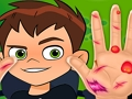 Игра Ben10 Ръчен лекар  онлайн